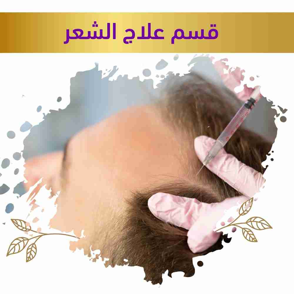 علاج الشعر