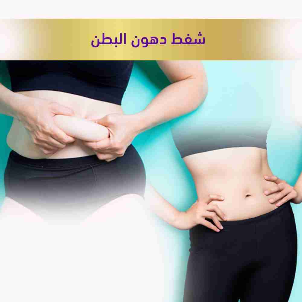 شفط دهون البطن