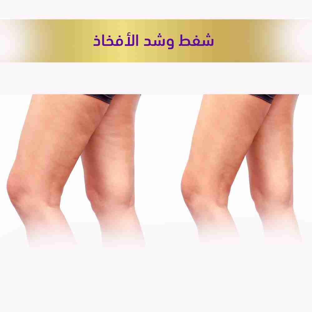 شفط وشد الافخاذ