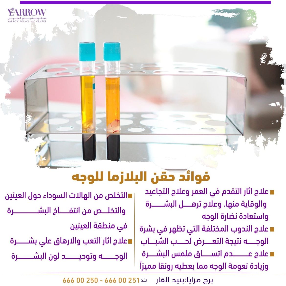 حقن البلازمه