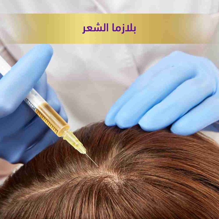 بلازمه-الشعر