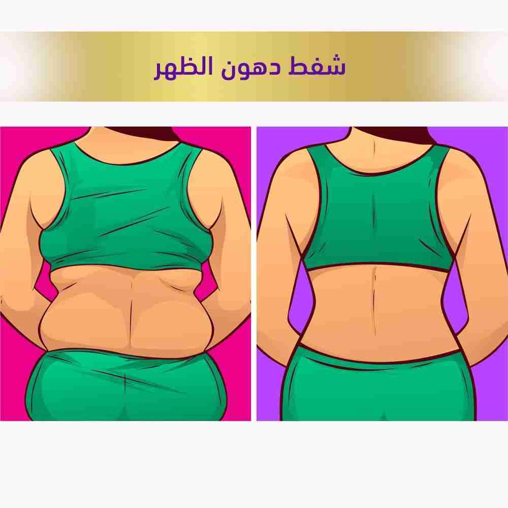 شفط دهون الظهر