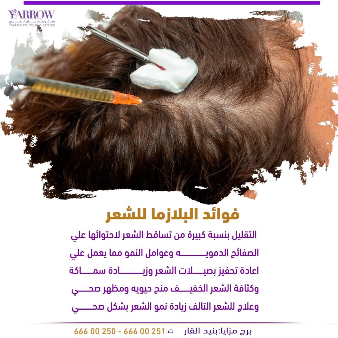 فوايد البلازمة للشعر
