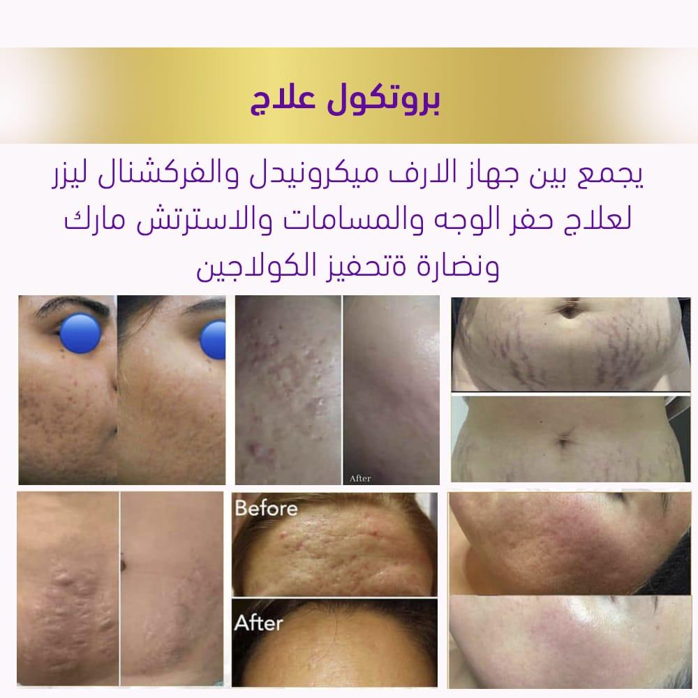 بروتوكول-علاج